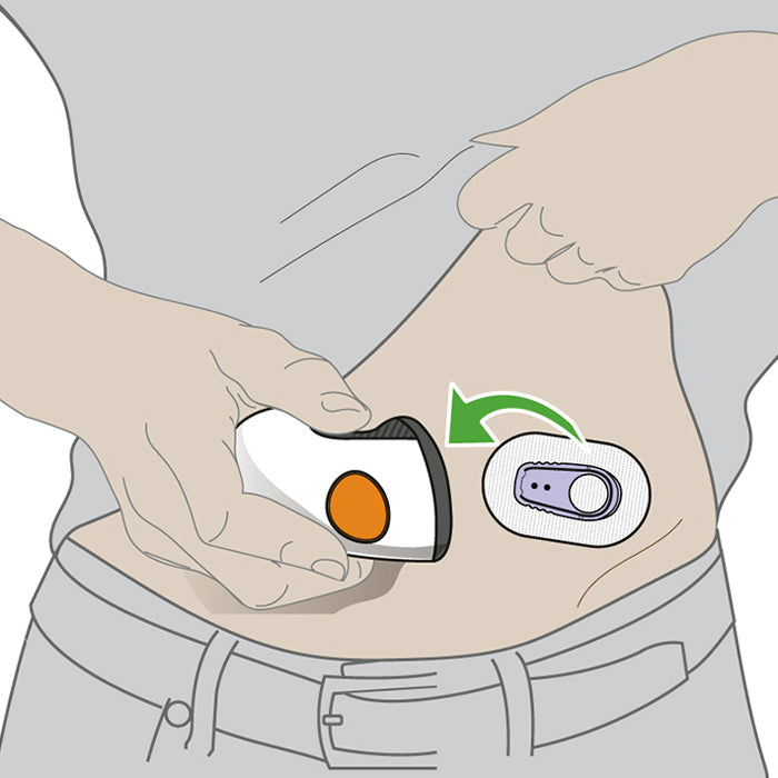 Dexcom G6 Sensor Application